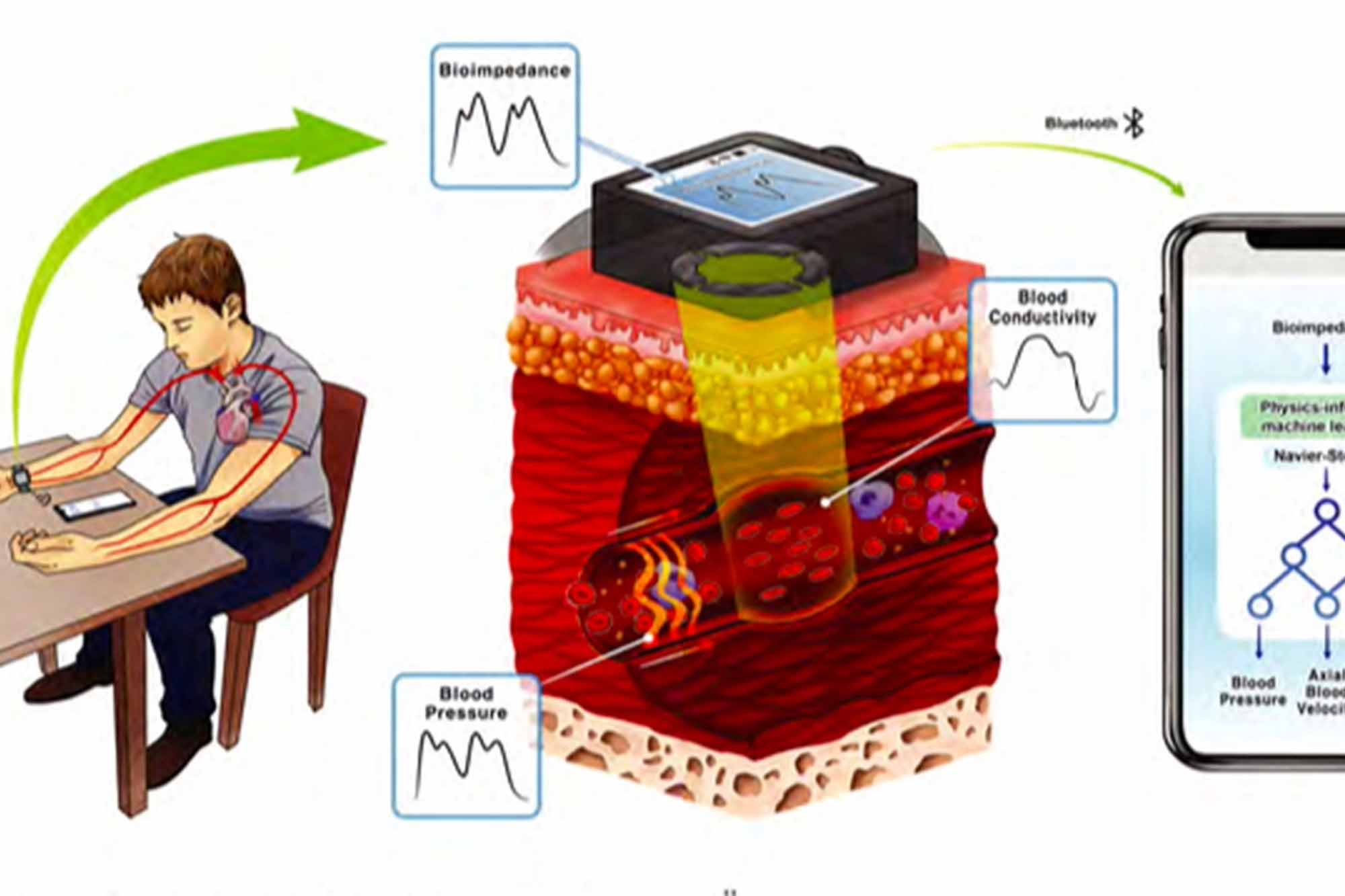 Graphic about monitoring blood pressure